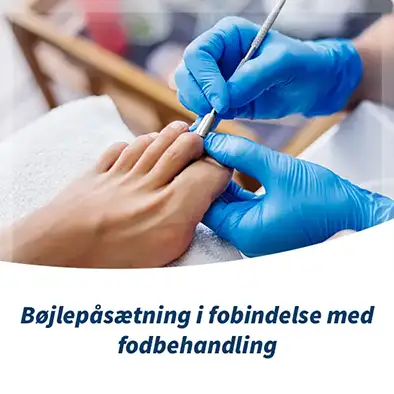 Bøjlebehandling