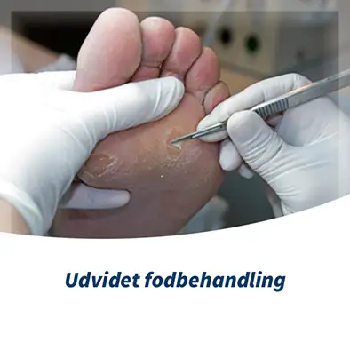 Udvidet Fodbehandling